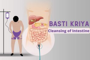 Basti Kriya (Yogic Enema): Cleansing of Intestines