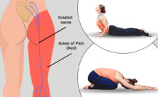 yoga for sciatica