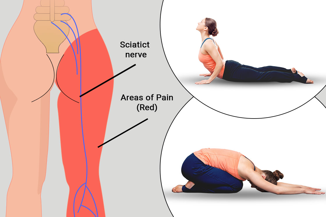 Sciatica - Step 4 - Breathing the right side of the belly - One Minute  Practice