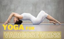 yoga for varicose veins