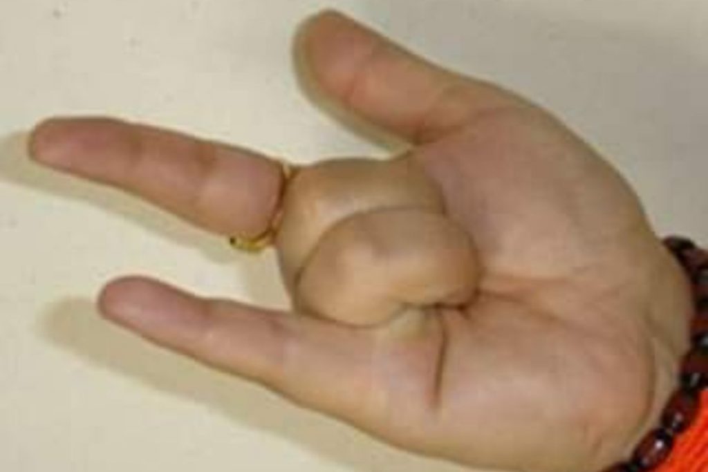 meao mudra for control blood pressure