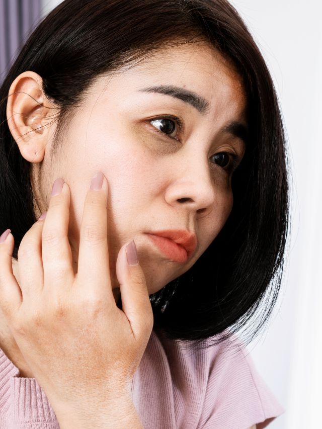 Yoga Exercise To Reduce Dark Circles Try These 8 Yoga Exercises to Reduce Dark Circles - Fitsri