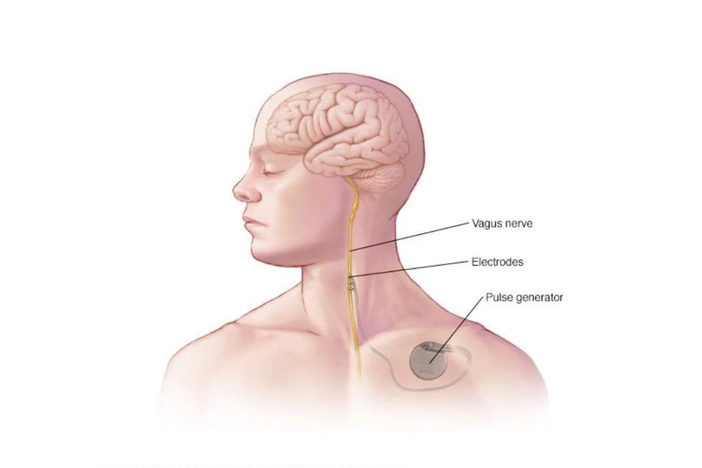 Anatomy and Function of the Vagus Nerve